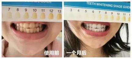 倪妮泳装露齿笑又迷倒一票人！湿法风格突然走火，牙白才敢这样玩