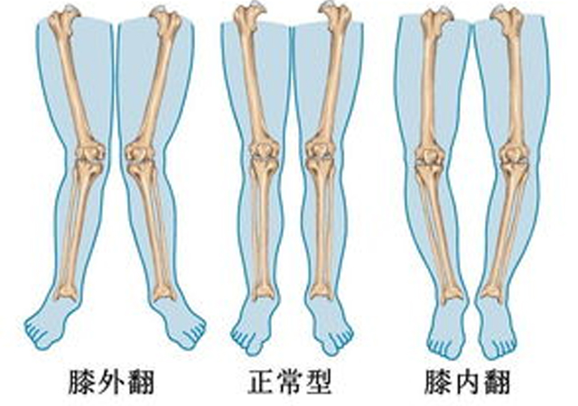 宝宝w型坐姿改不过来怎么办,孩子喜欢跪坐坐姿危害