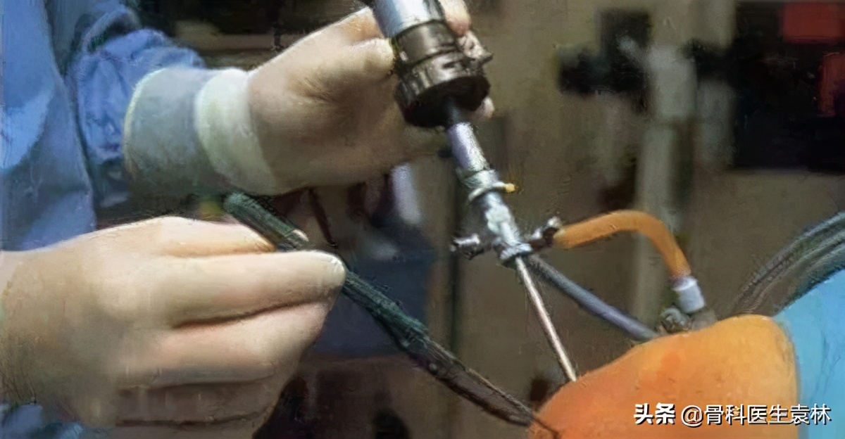 两侧骶髂关节退行性变,关节退行性变怎么锻炼