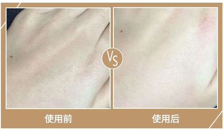 擦手霜保湿干裂起皮,冬季手干裂粗糙小妙招