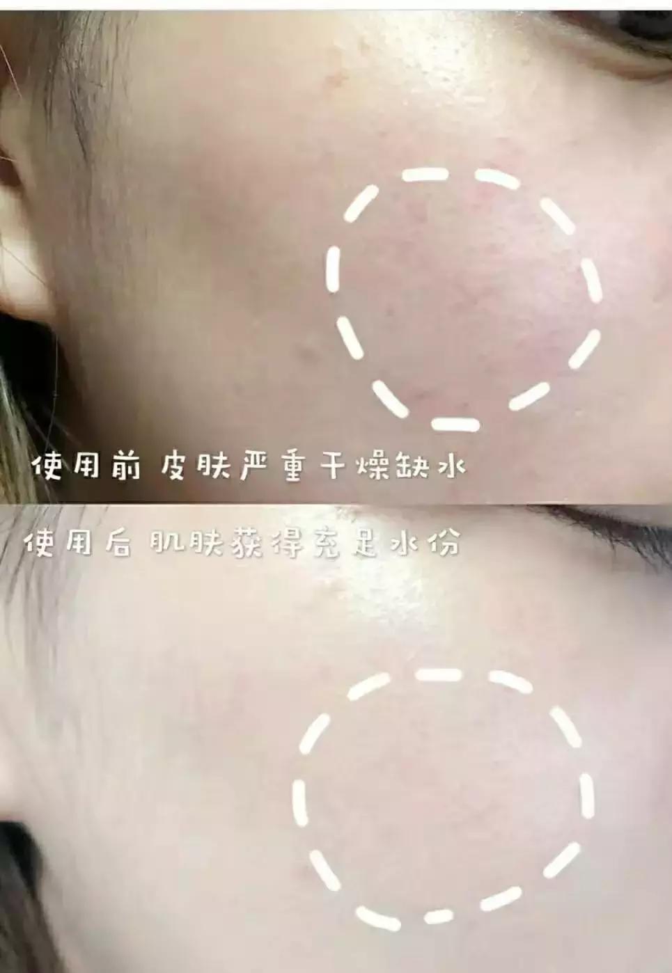 蜜梨六胜肽面霜李佳琦,日本蜜梨面霜李佳琦