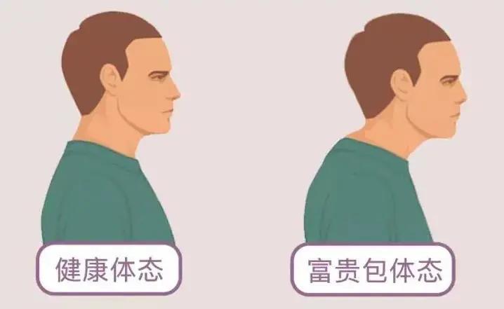 拒绝富贵包动作,拒绝富贵包的姿势