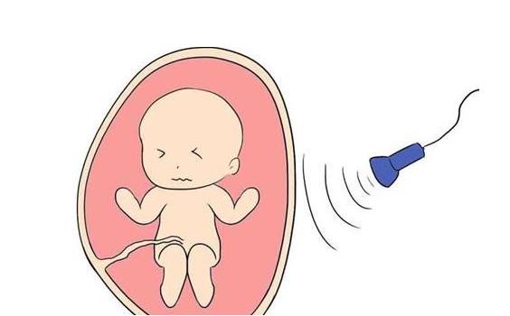 孕妇拍一次x光有多少辐射,拍片对孕妇的辐射有什么影响