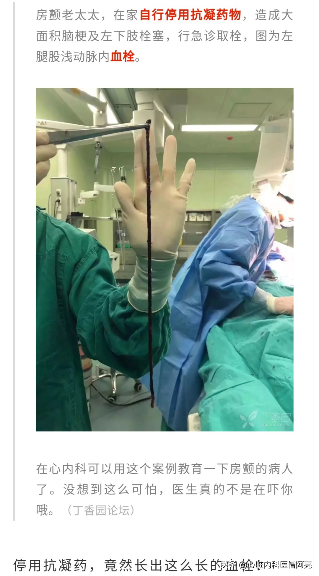 心脏有血栓能做房颤消融术吗,心脏房颤导致脑栓塞怎么治疗