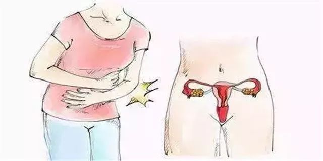 子宫肌瘤切了还长应该注意什么,子宫肌瘤会留下病根吗