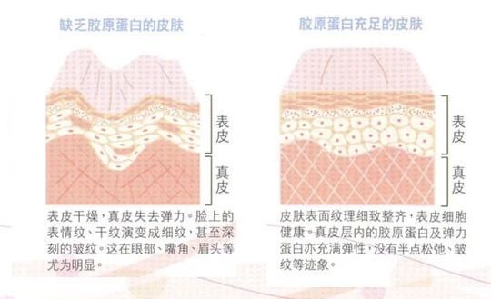 激光美白皮肤大概需要多少钱,私密激光美白多久能见到效果