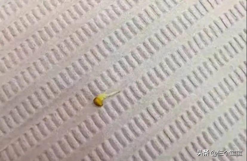 草莓籽在嘴里发了芽？刷牙少了这一步，你真的只是刷了个寂寞