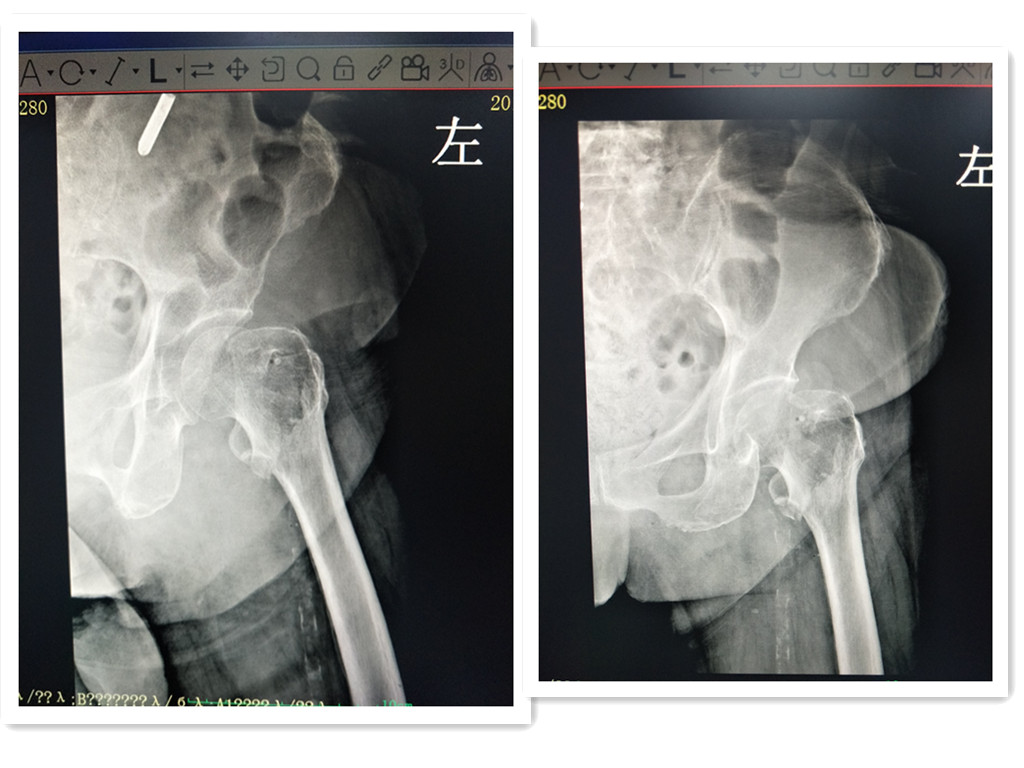 护佑百姓健康，诠释大医精诚—记广州东仁医院外二科团队