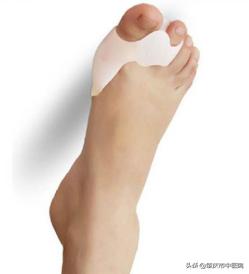 原来脚拇趾外翻是一种病，“元凶”竟是经常穿这种鞋有关！听听市中医院骨伤科专家怎么说……