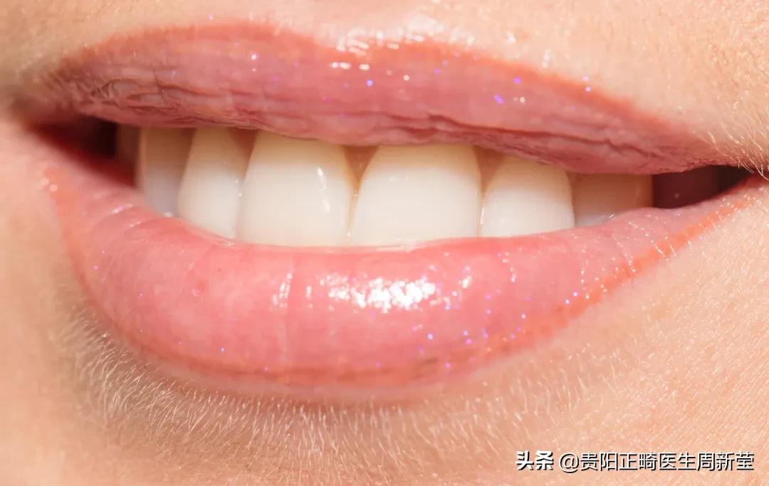 天天刷牙牙齿黑斑点,天天刷牙还是黄牙正确方法请收好