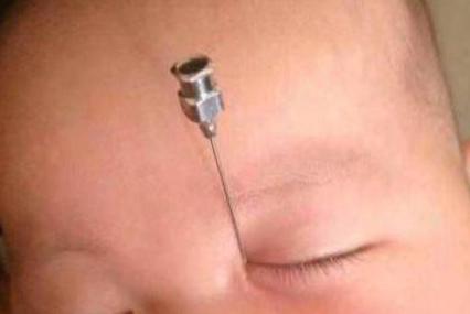 宝宝眼睛上火能用母乳擦眼睛吗,妈妈上火了宝宝吃母乳会眼泡肿吗