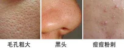 好皮肤怎么样养成的,好脸蛋