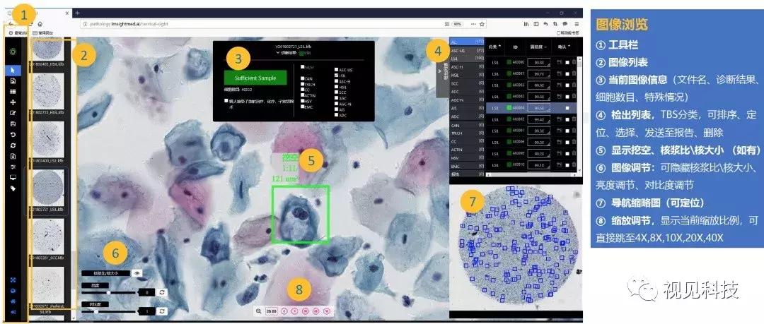 ai杈呭姪鐥呯悊璇婃柇,ai鐥呯悊璇婃柇瑙嗛
