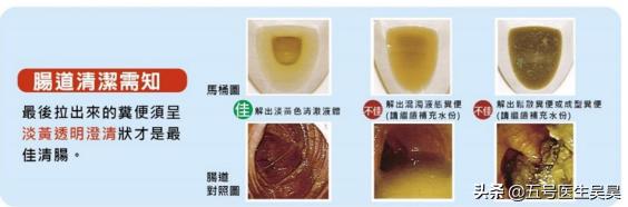 关于“大肠息肉”的6个问题，搞清楚再去检查也不迟