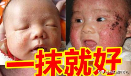 一般的湿疹膏,一擦就见效的护肤品打假