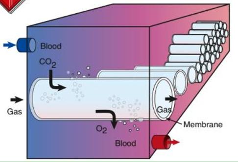 中国哪些呼吸机遭多国疯抢,中国呼吸机紧缺视频