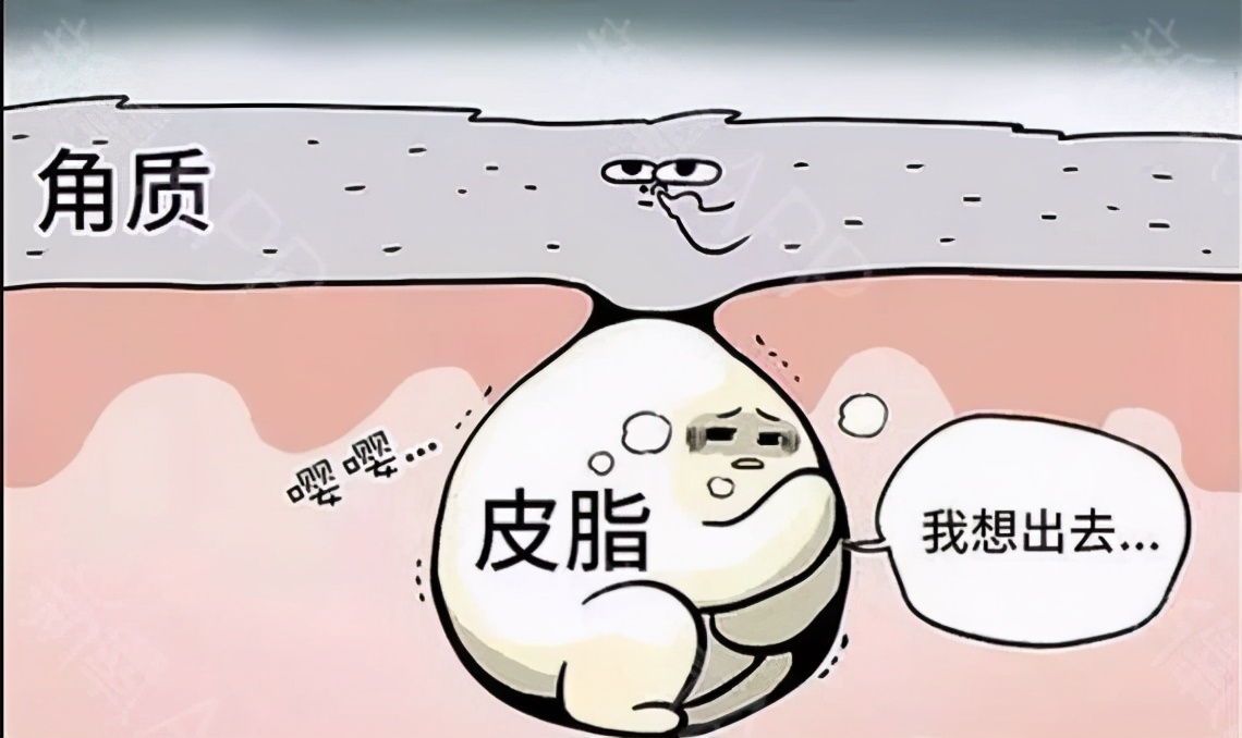 被黑头粉刺挤出来的痘痘怎么办,被粉刺闭口困扰怎么办