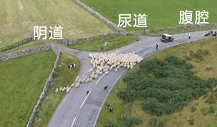 惊!三更半夜,孩子的“菊花”爬出了N条虫……