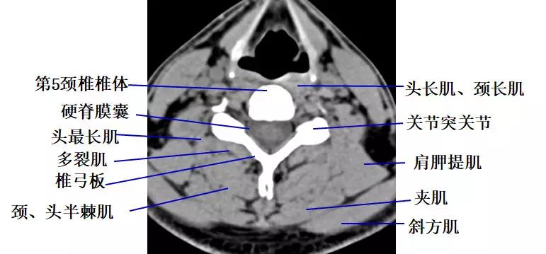 颈椎腰椎疾病ct及mri诊断,腰椎ct可以发现肠部病变吗