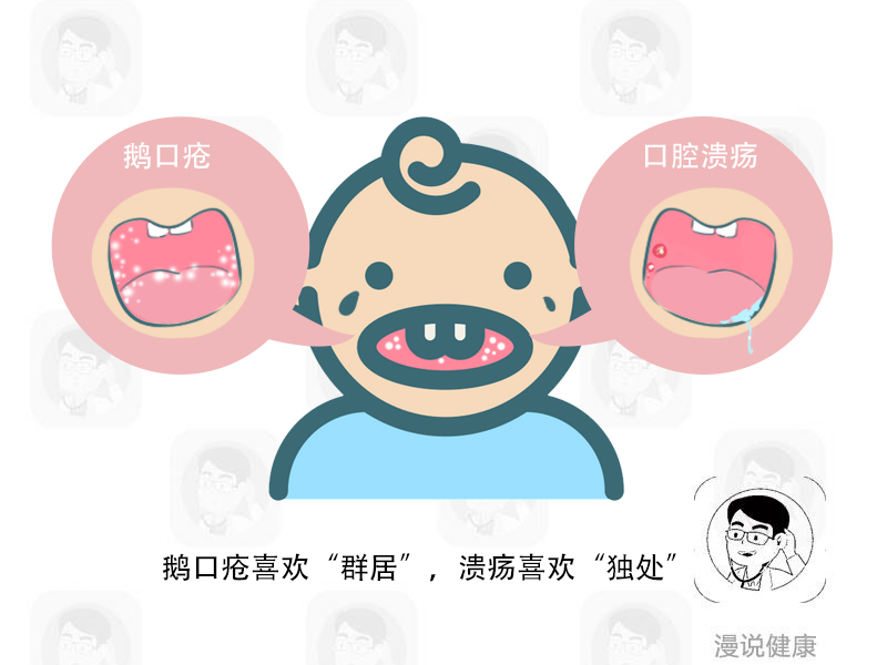 宝宝口疮和鹅口疮的区别,宝宝鹅口疮怎么治小妙招