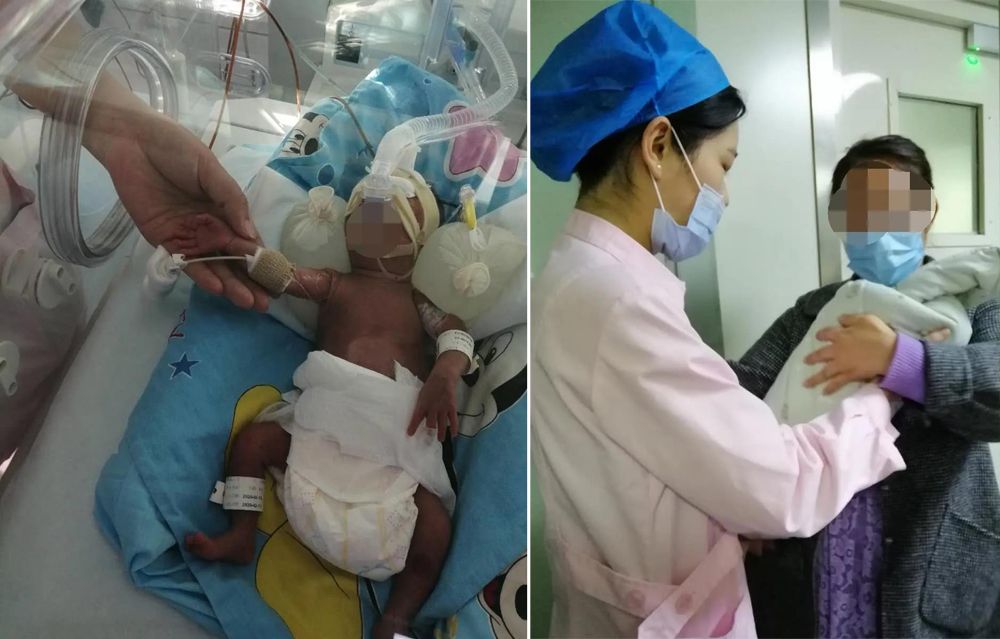 *安泰**一妊娠26周孕妇胎膜早破命悬一线，多科联合救治诞下早产宝宝