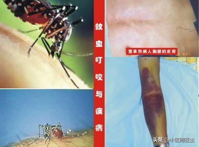 夏季蚊虫多怎么避免,哪些蚊虫可以传播登革热