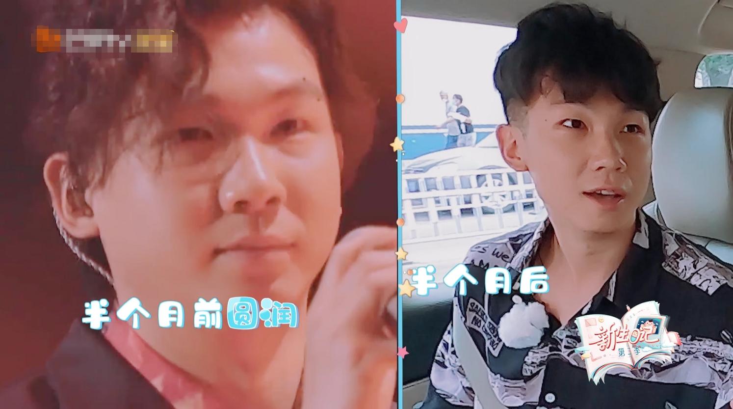 明星整容打瘦脸针,90后明星整容