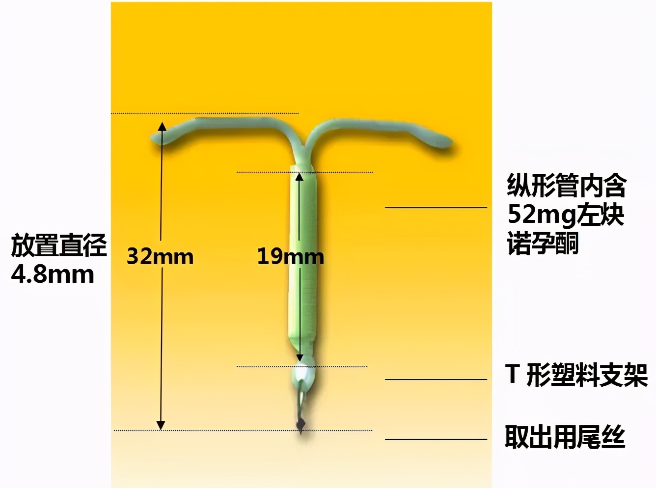 这个小玩意不仅能防“意外”，还能治疗妇科病
