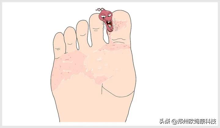 相信偏方不如相信抗菌鞋垫！不然一通操作猛如虎结果治疗全没谱