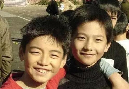 抗衰不再是简单的面部抗衰,风靡全球面部抗衰的最好方法