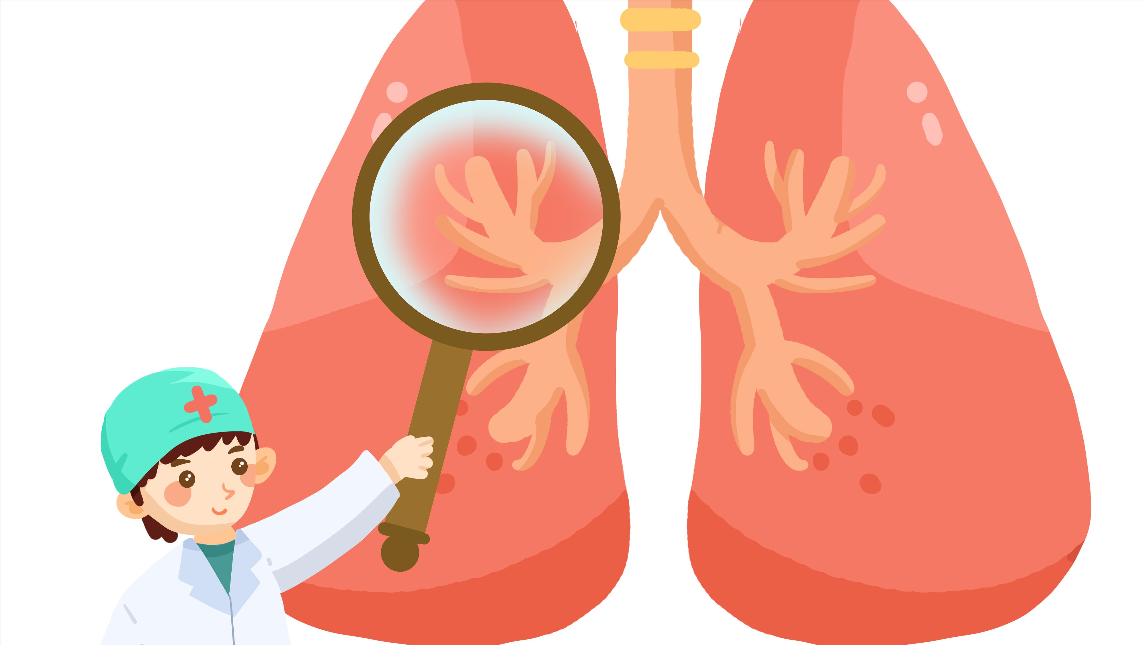 肺癌患者说的感人的话,谈谈肺癌的主要临床表现