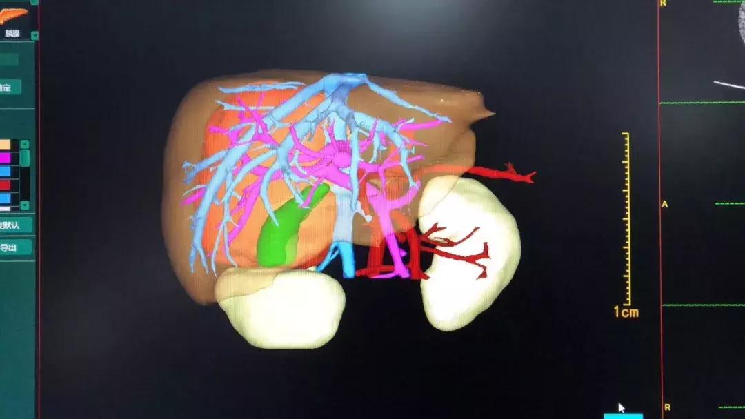 青岛4岁男童死亡,青岛4岁男孩车祸去世