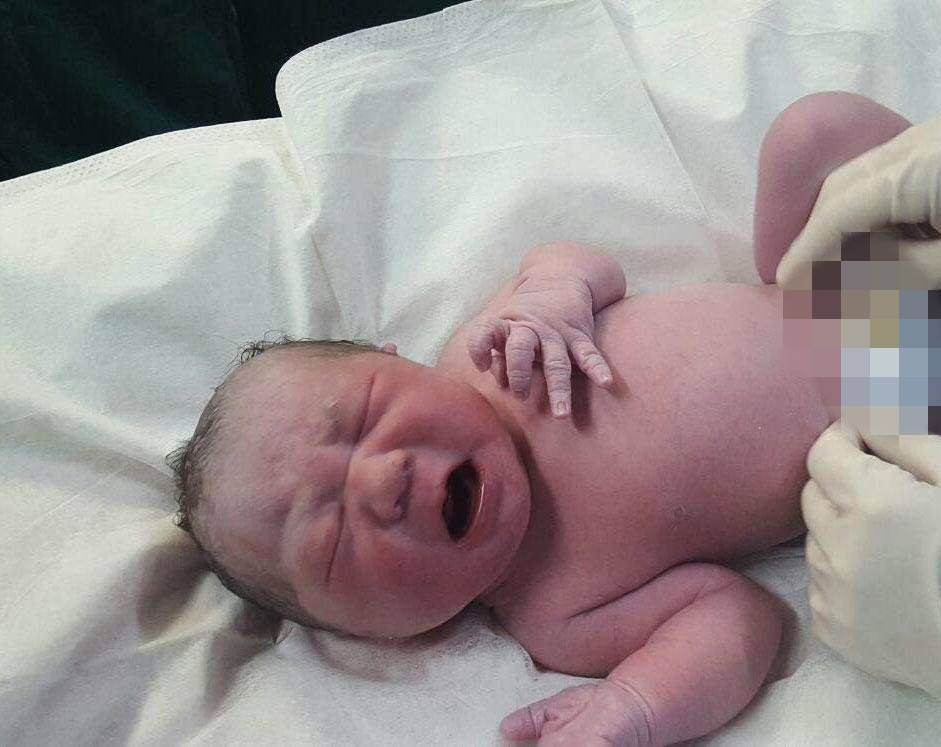 孕妈怀巨大儿想顺产,孕妈生出肉球