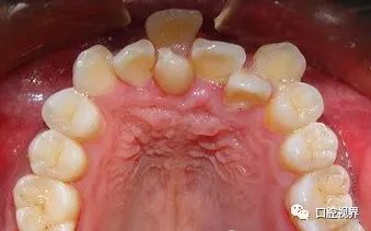 听说牙缝太大难看又露财，您给看看这牙缝还有救吗？