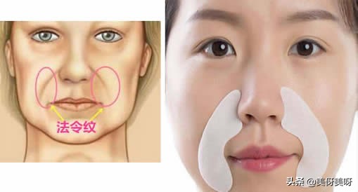 法令纹有什么方法消除小窍门,法令纹怎么消除四种方法帮助你