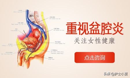 哪些人易患盆腔炎？如何预防与治疗？医生指导您走出误区