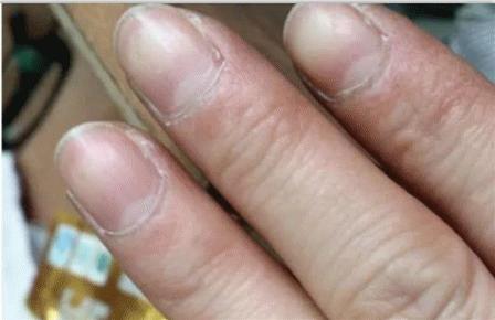 如何防止干家务手变粗糙,做家务手粗糙怎么快速改善