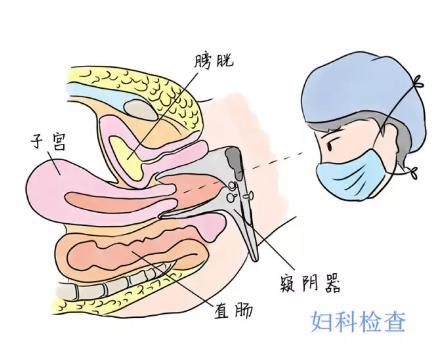 出血十天是宫颈癌吗,绝经后出血可能是宫颈癌