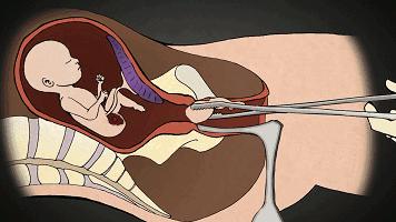 啪啪啪被孩子撞见，并问“你们在干嘛？”高明的家长是这样回答的