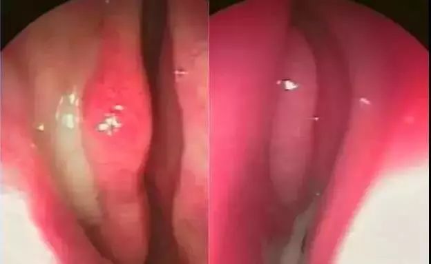 儿童鼻痒鼻塞鼻炎用什么喷剂,小孩鼻塞建议用什么鼻喷雾剂