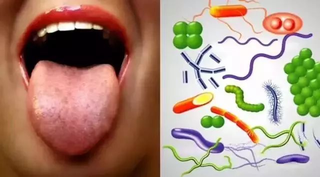 种草鸡丨惊呆了！30秒漱出扁桃体结石！