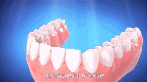 矫正牙齿不给报销吗,牙齿矫正为什么不能纳入医保