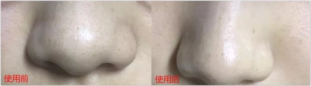 还在用洗面奶洗脸卸妆就out了！用它轻轻一刷，几秒就能深层清洁每个毛孔，感觉黑头都蹦出来了！