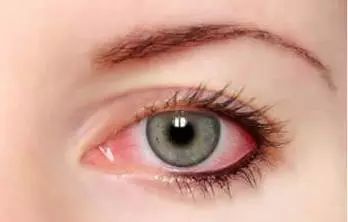 景甜同款洗眼神器,景甜洗眼液有哪些