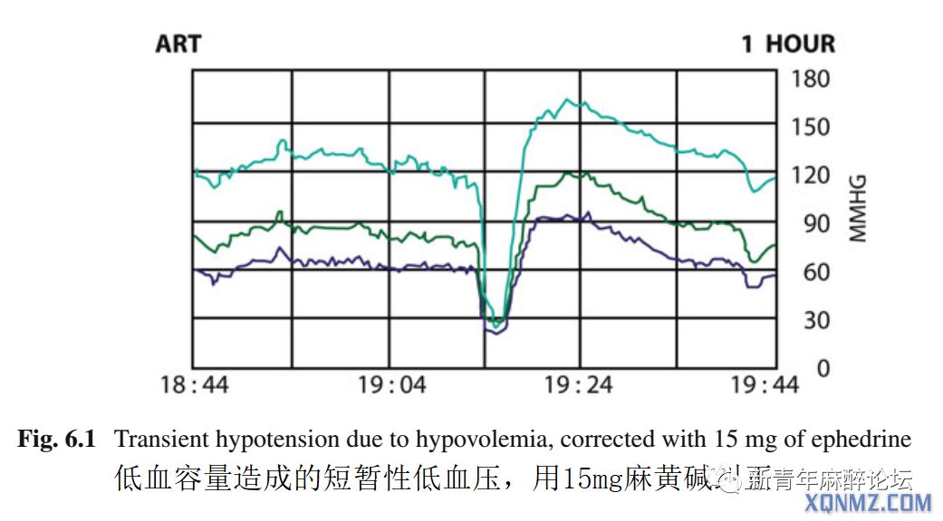 气管导管意外滑脱应急处理流程,气管突然闭合的急救方法