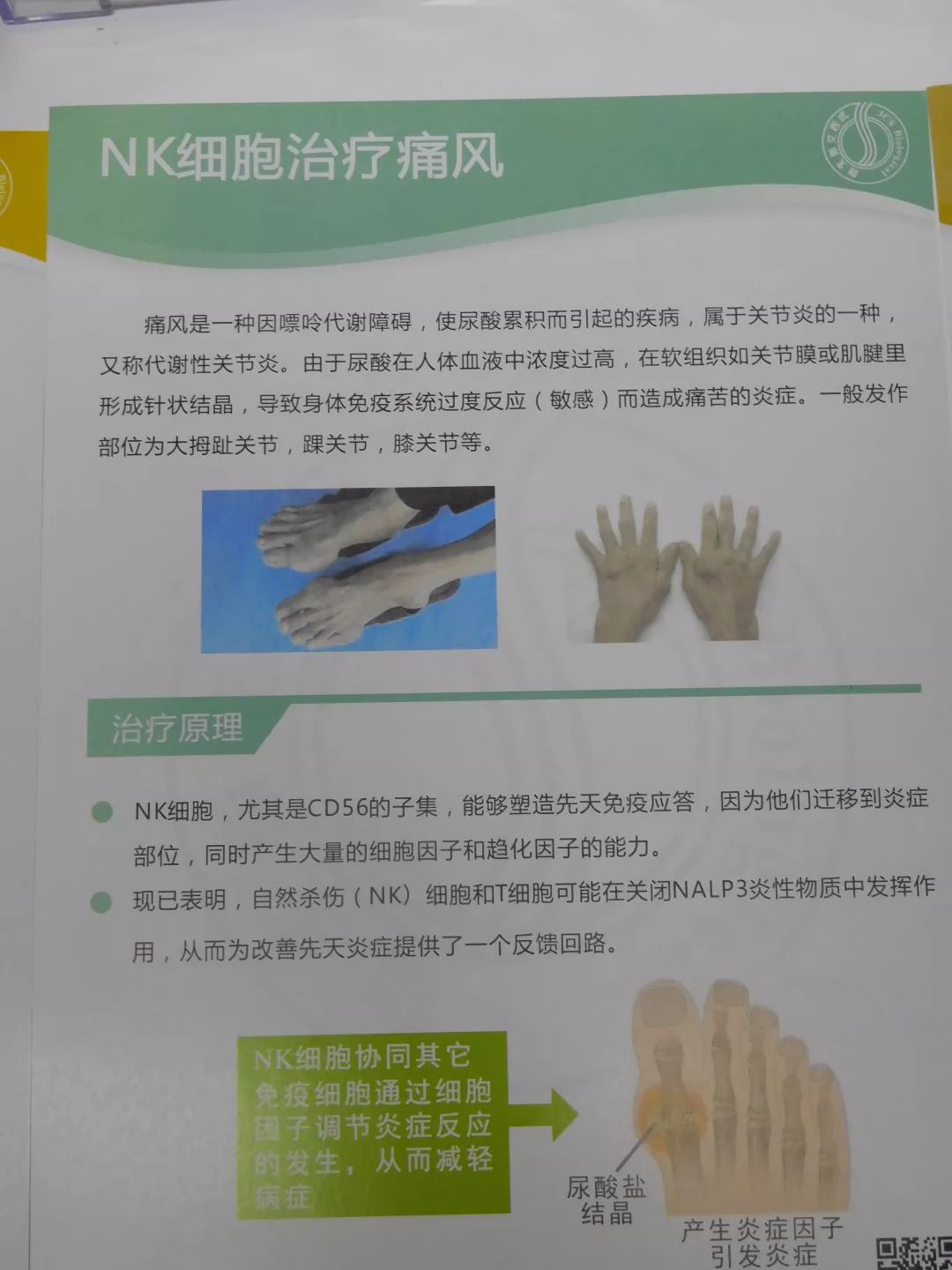 nk免疫疗法癌症,nk免疫疗法和正常细胞的区别