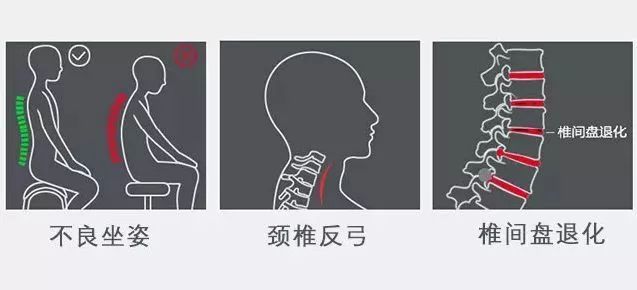 颈椎疼？脖子僵硬？睡觉用上它，颈椎病偏头痛全好了！