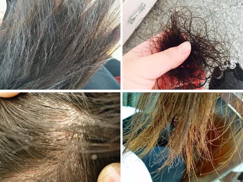 不用吹风机吹头发也可以变干,洗完头怎么不用吹风机弄干头发