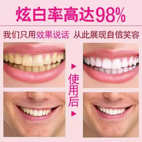 用了美白牙膏白了一颗牙,用了美白牙膏后还用清洁吗