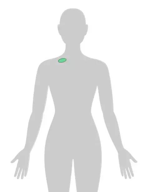 18张癌症人体地图，揭秘致癌真相！